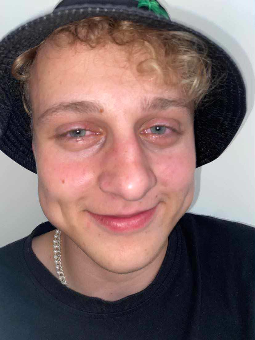 Loko